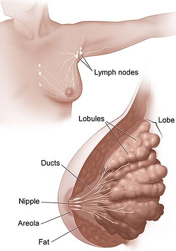 Medical illustration for the Breast Cancer information guide