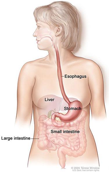 Medical illustration for the Stomach Cancer information guide