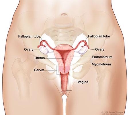 Medical illustration for the Ovarian Cancer information guide