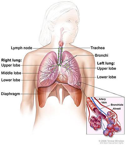 Medical illustration for the Lung Cancer information guide