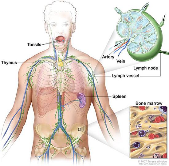 Medical illustration for the Lymphoma information guide