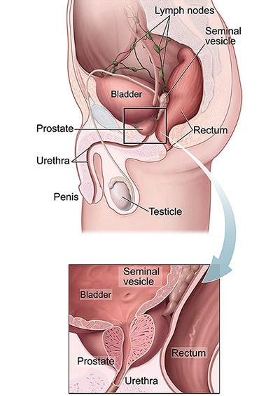 Medical illustration for the Prostate Cancer information guide